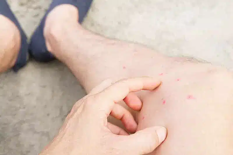 Les piqueurs les punaises les puces