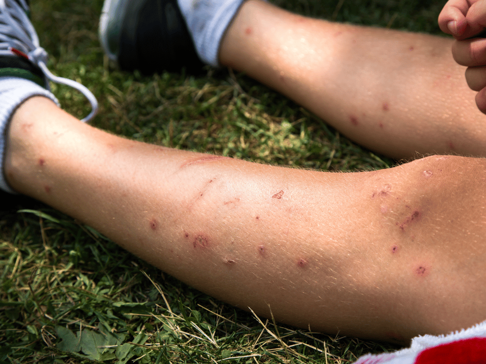 Dératisation Désinsectisation, Expert en punaises de lit au Luc