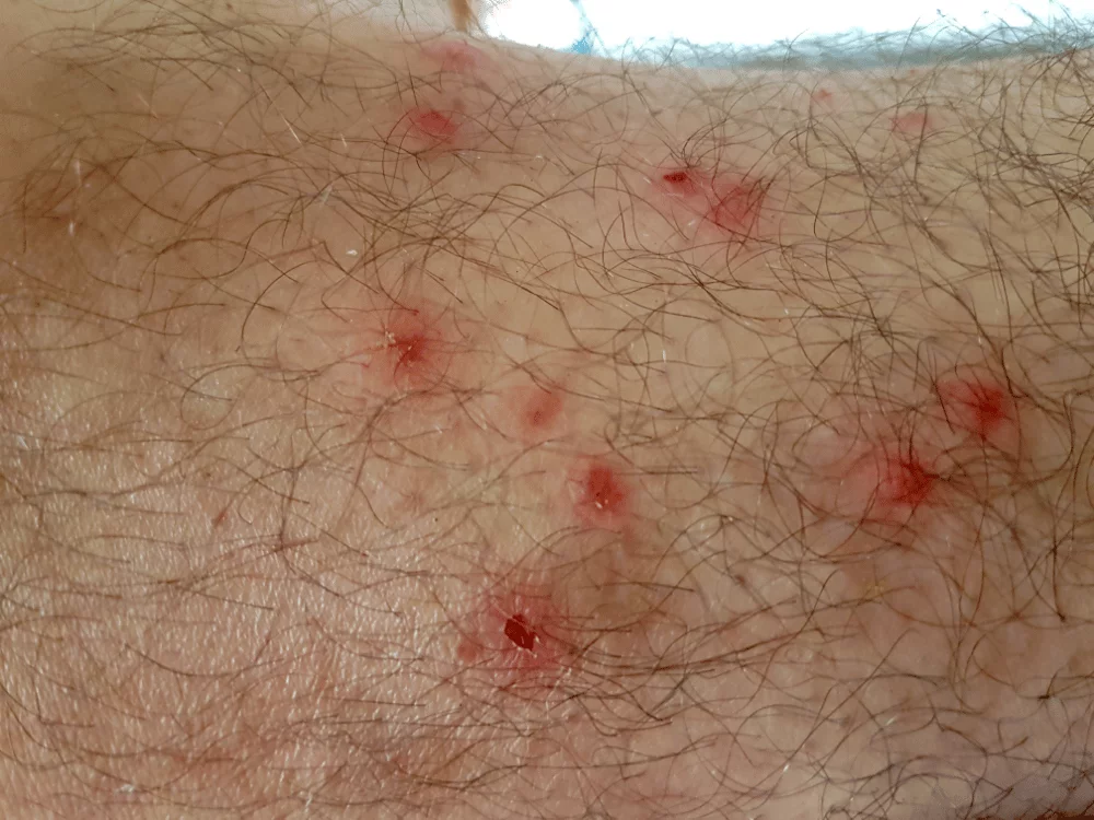 Dératisation Désinsectisation, Expert en punaises de lit à Lançon-Provence